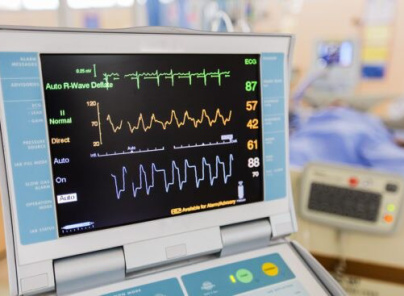 Bildschirm eines medizinischen Geräts mit Herzfrequenz- und EKG-Daten im Gesundheitszentrum.