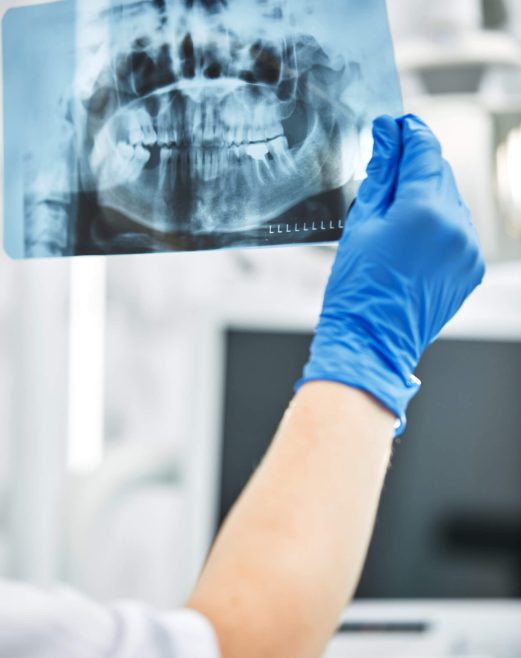 Röntgenbild eines Kiefers, das auf zahnmedizinische Diagnosen hinweist.